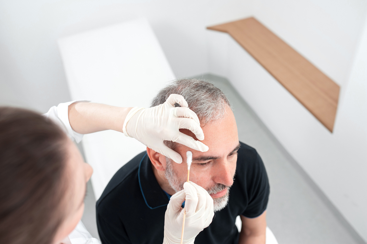 Chryotherapy used to Removed an Aged Spot